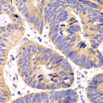 HMGCL Rabbit pAb