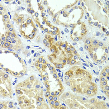 HMGCL Rabbit pAb