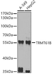 TRMT61B Rabbit pAb