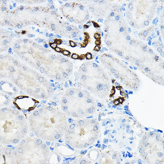 EVA1A Rabbit pAb