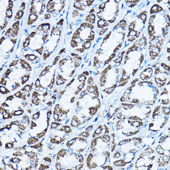 ATP5O Rabbit pAb