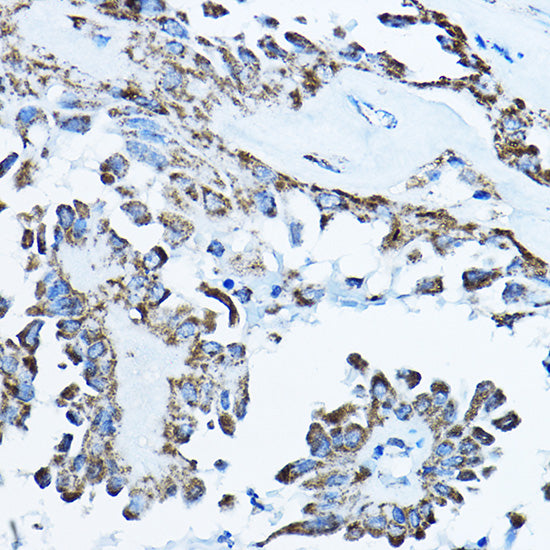 ATP5O Rabbit pAb