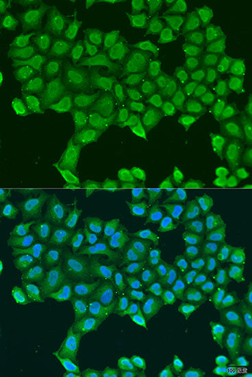 ATP5O Rabbit pAb