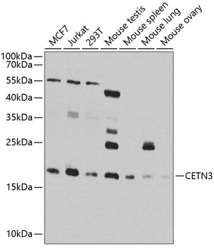 CETN3 Rabbit pAb
