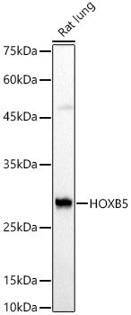 HOXB5 Rabbit pAb