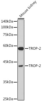 TROP-2 Rabbit pAb