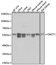 OXCT1 Rabbit pAb