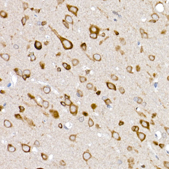 GLUT3/SLC2A3 Rabbit pAb