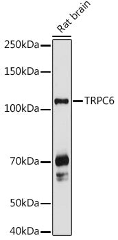 TRPC6 Rabbit pAb