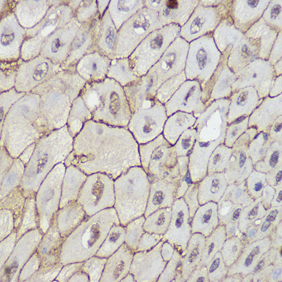 TRPC6 Rabbit pAb