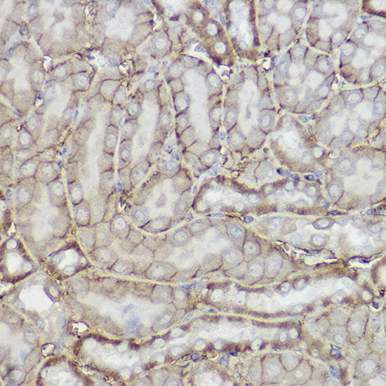 TRPC6 Rabbit pAb