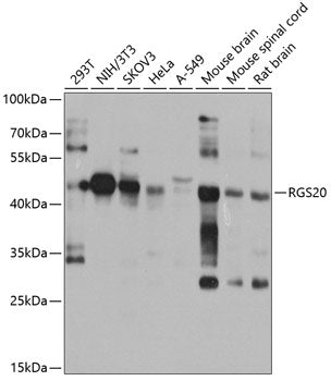 RGS20 Rabbit pAb