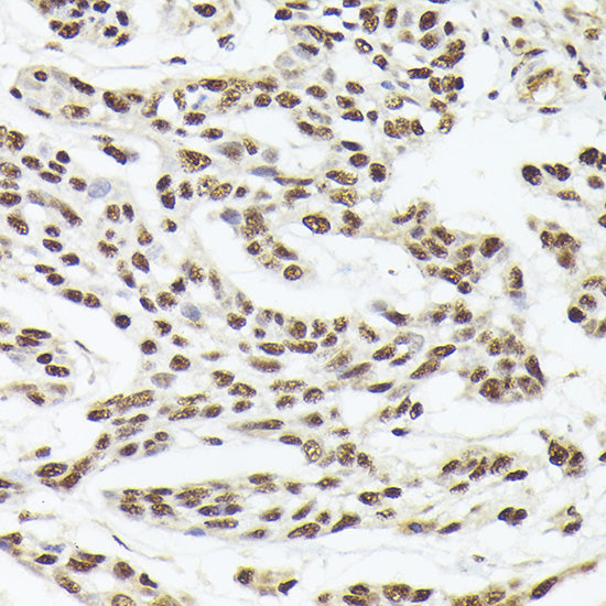 Nuclear Matrix Protein p84 (THOC1) Rabbit pAb