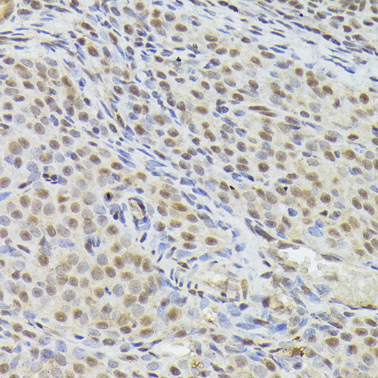 Nuclear Matrix Protein p84 (THOC1) Rabbit pAb