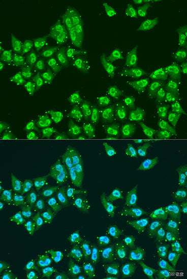 Nuclear Matrix Protein p84 (THOC1) Rabbit pAb