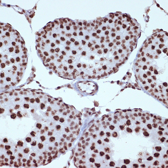 ILF3 Rabbit mAb