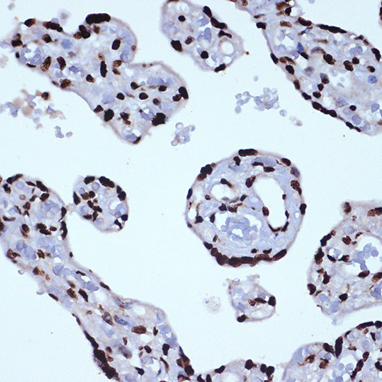 ILF3 Rabbit mAb