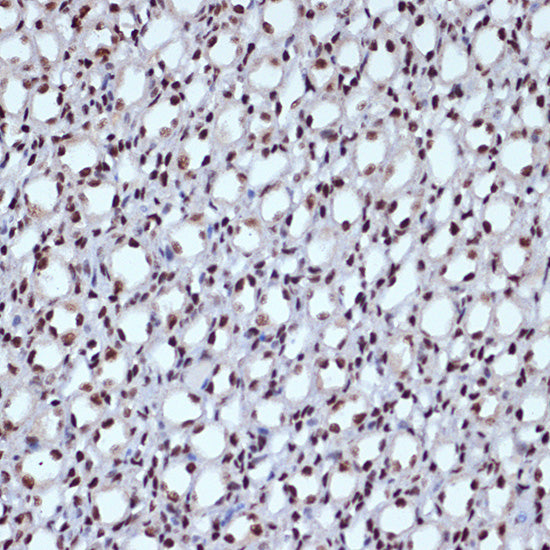 ILF3 Rabbit mAb