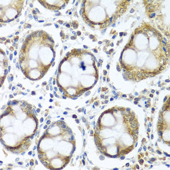 IFI44 Rabbit pAb