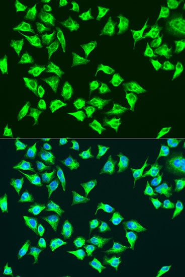ATP6 Rabbit pAb