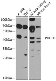 PDGFD Rabbit pAb