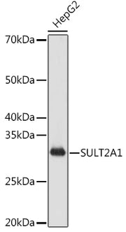 SULT2A1 Rabbit mAb