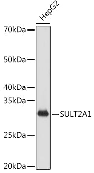 SULT2A1 Rabbit mAb