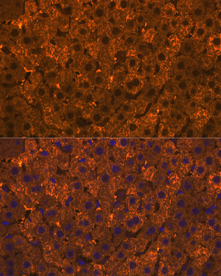 SULT2A1 Rabbit mAb