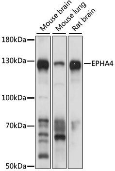 EPHA4 Rabbit pAb