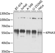 KPNA3 Rabbit pAb