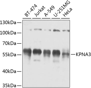 KPNA3 Rabbit pAb