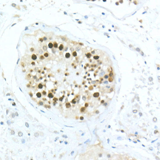 MDC1 Rabbit pAb