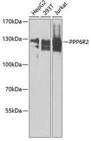 PPP6R2 Rabbit pAb