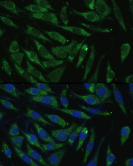 PITRM1 Rabbit pAb