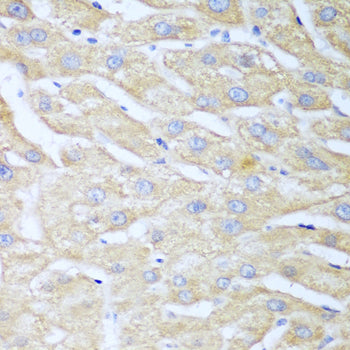NUDT15 Rabbit pAb
