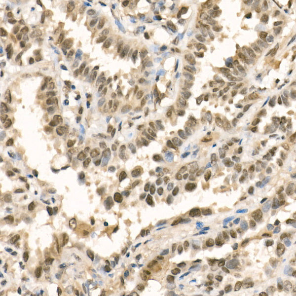 [KD Validated] METTL3 Rabbit pAb