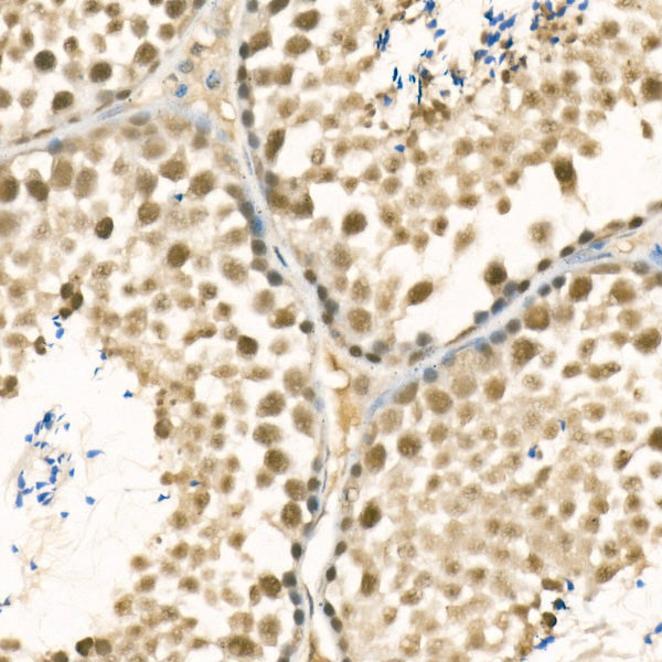 [KD Validated] METTL3 Rabbit pAb
