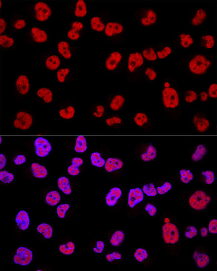 [KD Validated] METTL3 Rabbit pAb