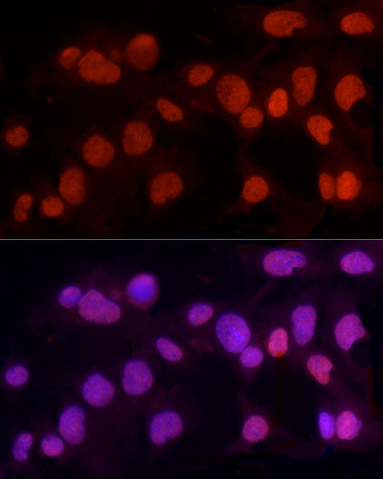[KD Validated] METTL3 Rabbit pAb