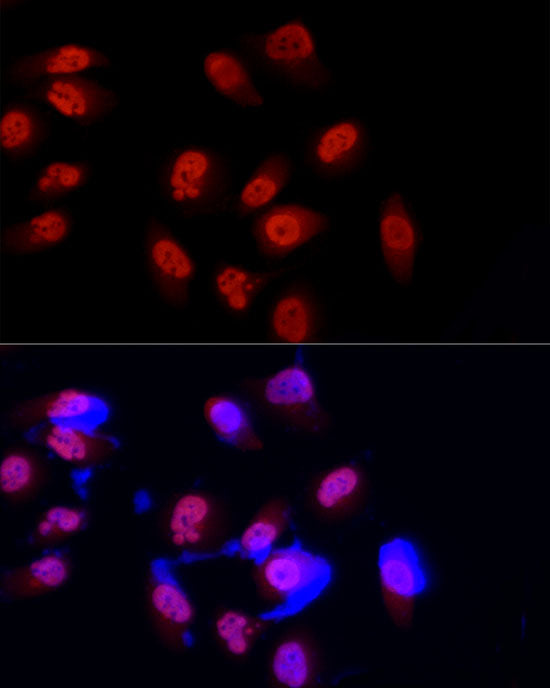 [KD Validated] METTL3 Rabbit pAb