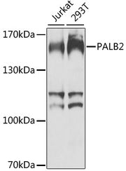 PALB2 Rabbit pAb