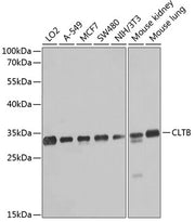 CLTB Rabbit pAb