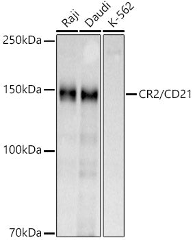 CR2/CD21 Rabbit pAb