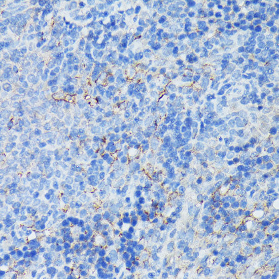 CR2/CD21 Rabbit pAb