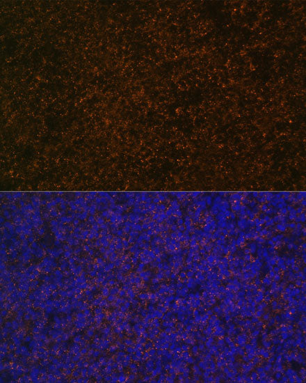 CR2/CD21 Rabbit pAb