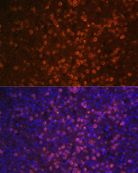 CR2/CD21 Rabbit pAb