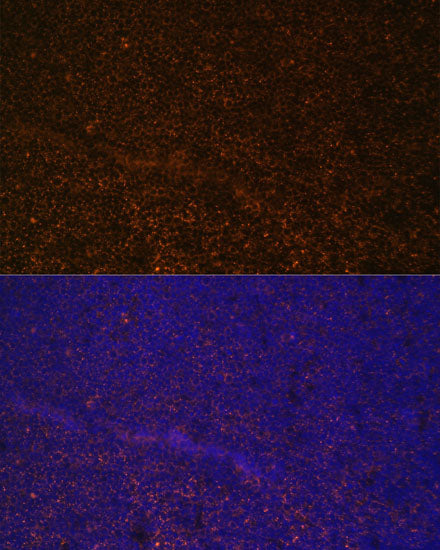 CR2/CD21 Rabbit pAb