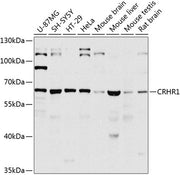 CRHR1 Rabbit pAb