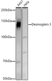 Desmoglein 3 Rabbit pAb