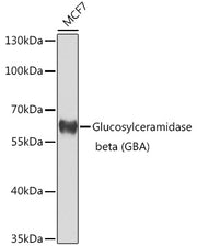 Glucosylceramidase beta (GBA) Rabbit pAb